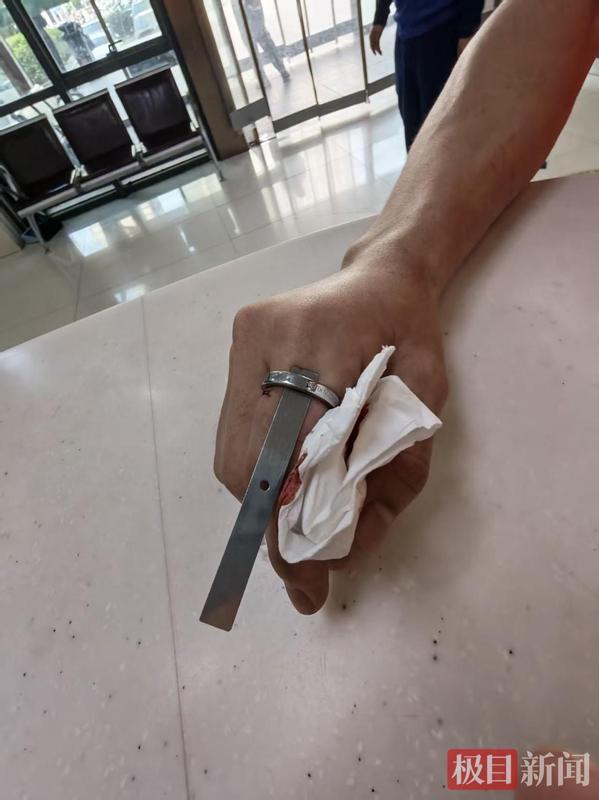 一枚戒指差点废掉他的手指！消防和医生联手"拆弹"背后的惊险24小时